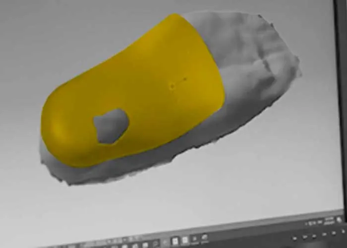 conception-modelisations-semelles-3d